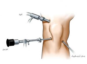 arthroscopy-devices